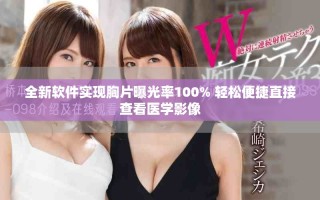 全新軟件實現(xiàn)胸片曝光率100% 輕松便捷直接查看醫(yī)學(xué)影像
